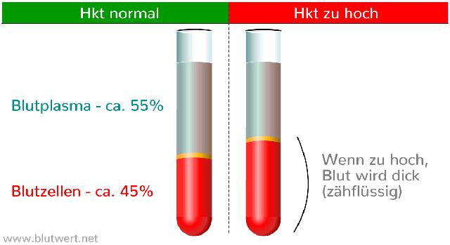 Alkoholkonsum und Hämatokrit: Wie beeinflusst er den Blutwert? Alkoholkonsum und Hämatokrit: Wie beeinflusst er den Blutwert?