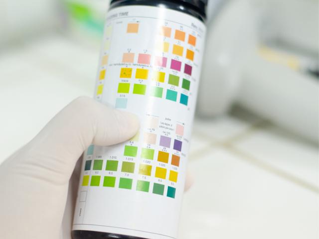 Hydrogencarbonat: Die Wirkung im Körper und ihre gesundheitlichen Aspekte Hydrogencarbonat: Die Wirkung im Körper und ihre gesundheitlichen Aspekte