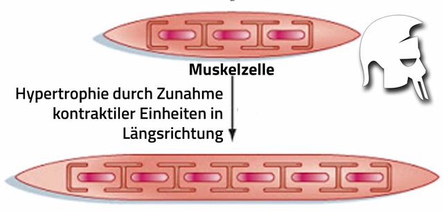 Verständnis von Hypertrophie: Größenzunahme ohne Zellvermehrung