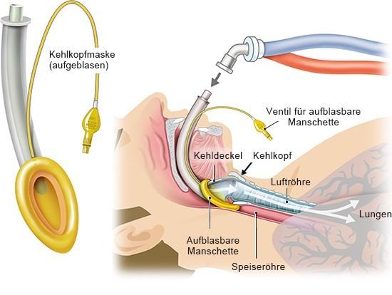 Intubation: Definition, Ablauf und Risiken Intubation: Definition, Ablauf und Risiken