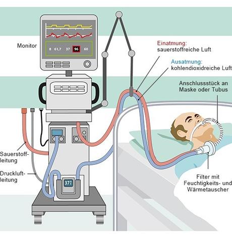 Intubation erklärt: Was ist das und wie läuft der Vorgang ab? Intubation erklärt: Was ist das und wie läuft der Vorgang ab?