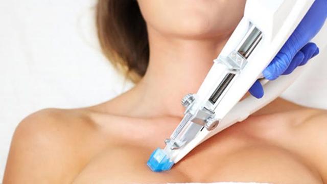 Mesotherapie: Innovative Methode zur Hautregeneration und Faltenreduktion Mesotherapie: Innovative Methode zur Hautregeneration und Faltenreduktion