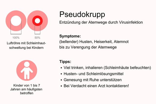 Was ist Pseudokrupp? Informationen zu Symptomen und Risikofaktoren Was ist Pseudokrupp? Informationen zu Symptomen und Risikofaktoren