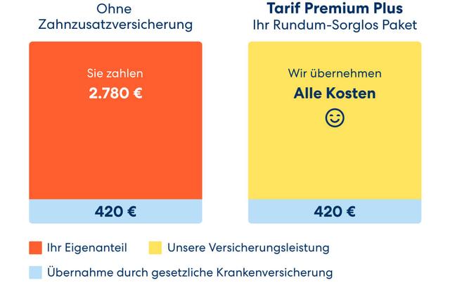3. Wann lohnt sich eine Zahnzusatzversicherung für mich? 3. Wann lohnt sich eine Zahnzusatzversicherung für mich?