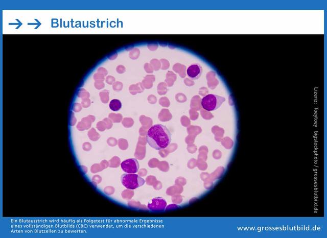 Die Diagnostik des Hämatologen: Wie werden Blut- und Immunerkrankungen festgestellt? Die Diagnostik des Hämatologen: Wie werden Blut- und Immunerkrankungen festgestellt?