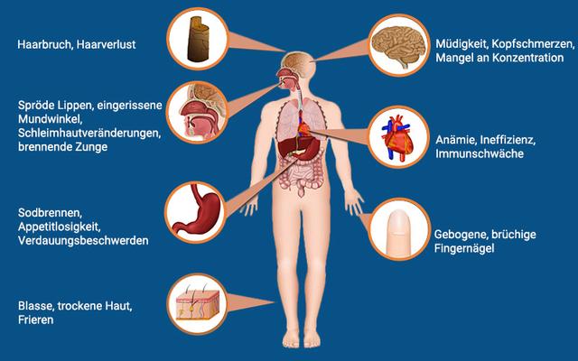 Eisenmangelanämie: Ursachen, Symptome und Diagnose Eisenmangelanämie: Ursachen, Symptome und Diagnose