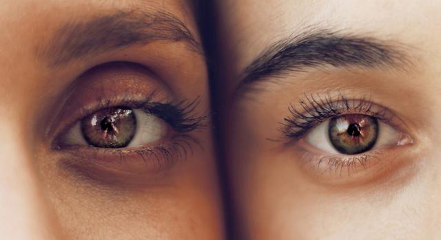 Schlupflider: Entstehung, Symptome und Lösungen für hängende Augenlider