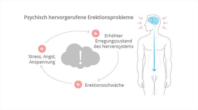 Ursachen von Erektionsproblemen und Behandlungsmöglichkeiten Ursachen von Erektionsproblemen und Behandlungsmöglichkeiten