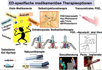 Behandlungsmöglichkeiten bei Erektionsstörungen: Von Medikamenten bis hin zur Vakuumtherapie Behandlungsmöglichkeiten bei Erektionsstörungen: Von Medikamenten bis hin zur Vakuumtherapie