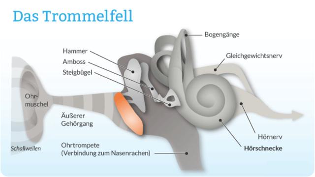 Wie man eine geplatzte Trommelfellperforation behandelt Wie man eine geplatzte Trommelfellperforation behandelt