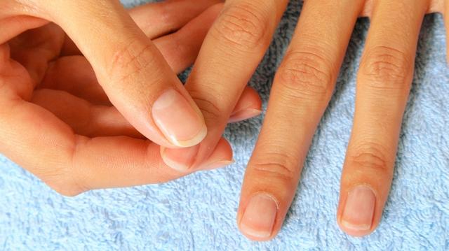 Prävention von Nagelbettentzündungen: Tipps für gesunde Nägel Prävention von Nagelbettentzündungen: Tipps für gesunde Nägel