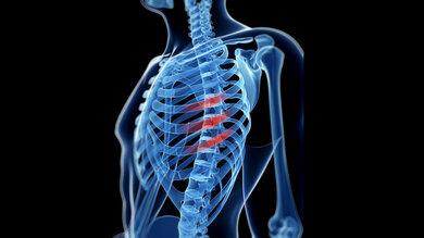 Soforthilfe bei Rippenbruch: Was Sie tun können, um die Schmerzen zu lindern