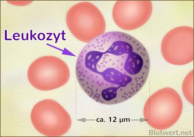 Wie kann man hohe Leukozytenwerte senken?
