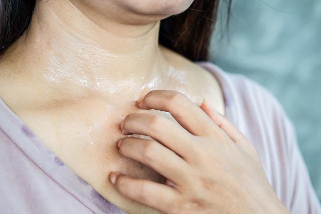 Hausmittel gegen Hitzepickel: Natürliche Lösungen für die Hautkrankheit Hausmittel gegen Hitzepickel: Natürliche Lösungen für die Hautkrankheit