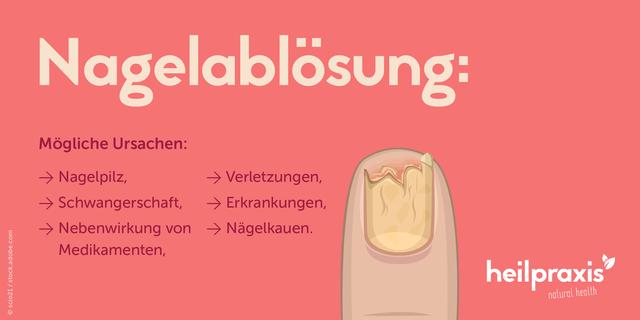 Ursachen und Behandlung von Nagelablösungen nach Verletzungen Ursachen und Behandlung von Nagelablösungen nach Verletzungen