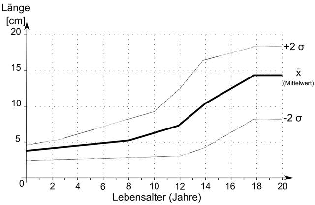 Mikropenis: Eine detaillierte Erklärung zu Größe, Entwicklung und möglichen Behandlungen Mikropenis: Eine detaillierte Erklärung zu Größe, Entwicklung und möglichen Behandlungen
