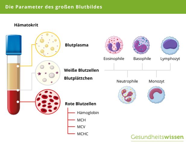 Die wichtigsten Parameter beim großen Blutbild erklärt