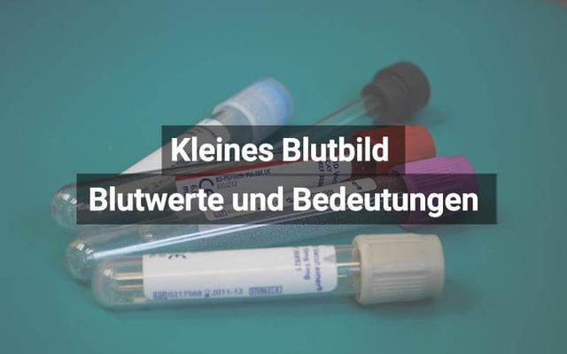 Bedeutung des kleinen Blutbilds: Welche Tests werden durchgeführt? Bedeutung des kleinen Blutbilds: Welche Tests werden durchgeführt?