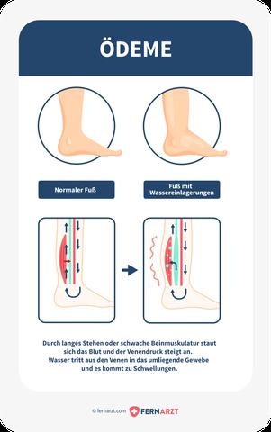 Wie lange dauert es, bis sich der Körper von Wassereinlagerungen nach der Menstruation erholt?