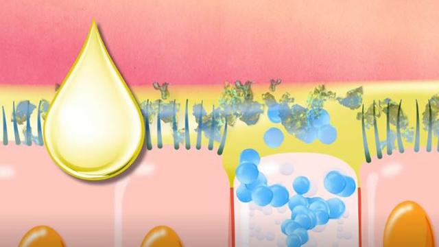 Nasensekretfarbe: Was sagt sie über den Verlauf einer Infektion aus? Nasensekretfarbe: Was sagt sie über den Verlauf einer Infektion aus?