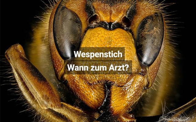 Wespenstich: Wann ist ein Arztbesuch erforderlich? Wespenstich: Wann ist ein Arztbesuch erforderlich?