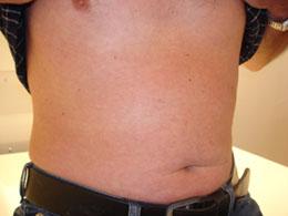 Wichtige Anzeichen einer HIV-Infektion nicht übersehen Wichtige Anzeichen einer HIV-Infektion nicht übersehen