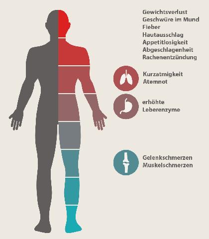 Symptome einer HIV-Infektion rechtzeitig erkennen und behandeln Symptome einer HIV-Infektion rechtzeitig erkennen und behandeln