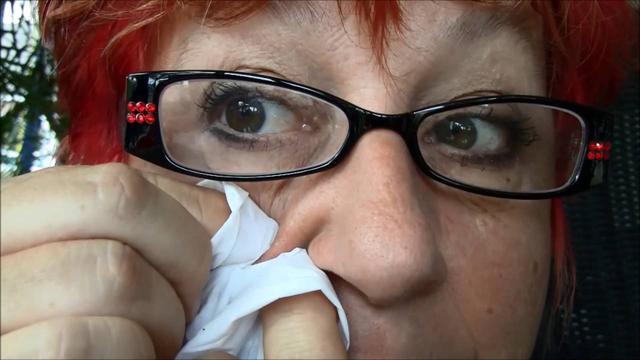 Milien entfernen mit einer Nadel: Die richtige Vorgehensweise für zu Hause Milien entfernen mit einer Nadel: Die richtige Vorgehensweise für zu Hause