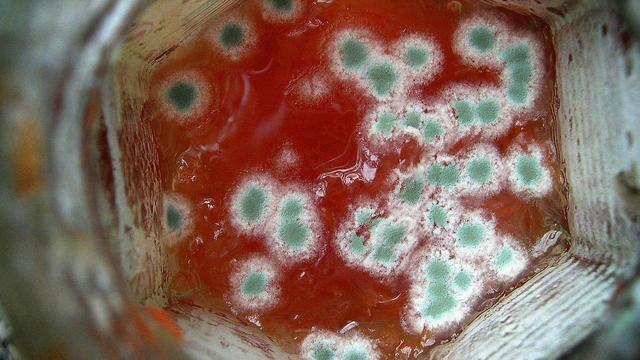 Wie lange sind die Symptome einer Lebensmittelvergiftung?