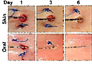 Loch im Mund nach einer Zahnoperation: Wie lange dauert die Heilung? Loch im Mund nach einer Zahnoperation: Wie lange dauert die Heilung?