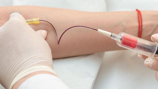 Wie lange dauert es, bis sich eine Fettleber zurückbildet? Wie lange dauert es, bis sich eine Fettleber zurückbildet?