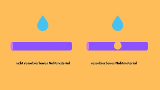 Selbstauflösende Fäden: Wann erfolgt die Auflösung?