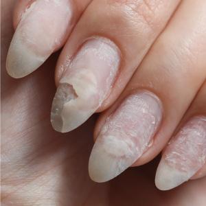 Wie lange halten Gelnägel bei Nagelbeißern? Wie lange halten Gelnägel bei Nagelbeißern?