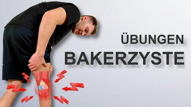Dauer der Krankschreibung nach Entfernung einer Bakerzyste