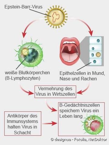 Infektionsrisiko bei Pfeifferschem Drüsenfieber: Wie lange besteht die Gefahr einer Ansteckung? Infektionsrisiko bei Pfeifferschem Drüsenfieber: Wie lange besteht die Gefahr einer Ansteckung?
