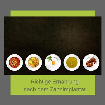 Nach Zahnimplantaten: Wann können Sie wieder normale Lebensmittel zu sich nehmen? Nach Zahnimplantaten: Wann können Sie wieder normale Lebensmittel zu sich nehmen?