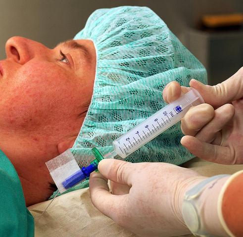 Schlafdauer nach Vollnarkose: Was Sie erwartet