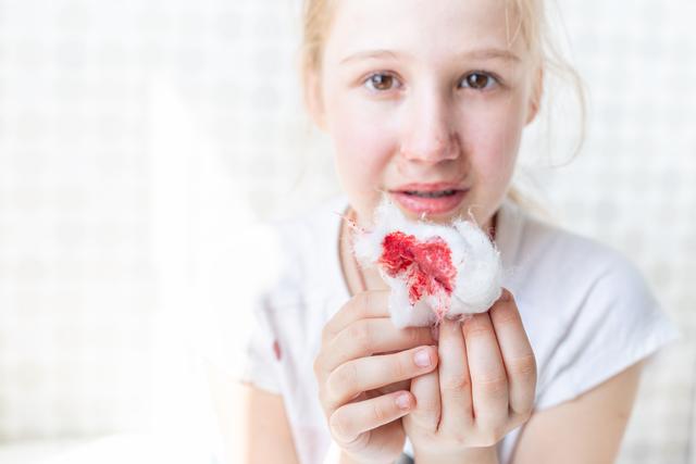 Häufiges Nasenbluten bei Kindern: Wann wird es bedenklich? Häufiges Nasenbluten bei Kindern: Wann wird es bedenklich?