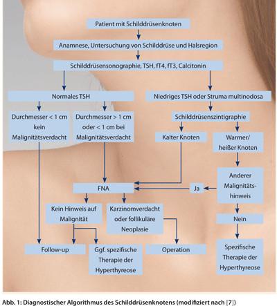 Wachstumsgeschwindigkeit von Knoten in der Schilddrüse