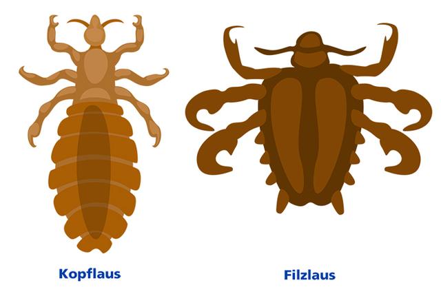 Visuelle Anleitung: So sehen Kopfläuse in der Nähe der Kopfhaut aus Visuelle Anleitung: So sehen Kopfläuse in der Nähe der Kopfhaut aus