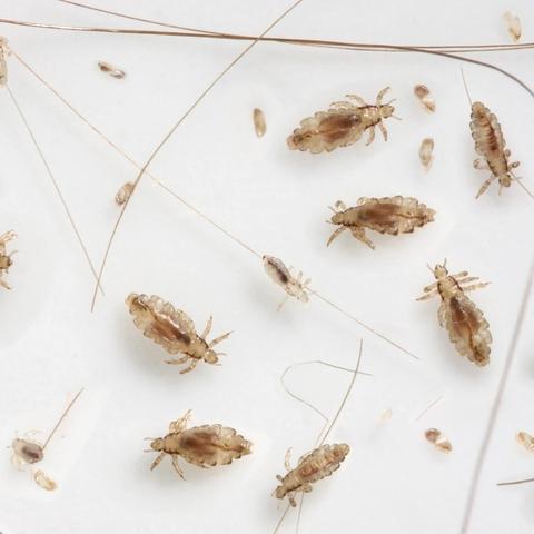 Kopfläuse erkennen: Wie sehen sie aus und wie unterscheidet man sie von anderen Insekten? Kopfläuse erkennen: Wie sehen sie aus und wie unterscheidet man sie von anderen Insekten?