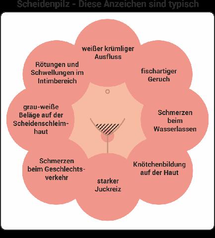 Was zeigt sich auf Bildern von Scheidenpilz? Erkennen Sie die typischen Merkmale.