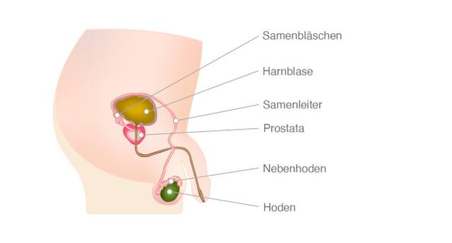 Prostatakarzinom im fortgeschrittenen Stadium: Sterben Männer an den Folgen der Erkrankung?