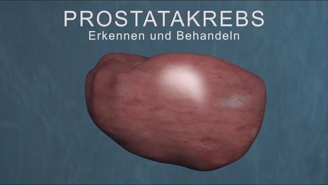 Fortgeschrittener Prostatakrebs: Lebenserwartung und mögliche Todesursachen