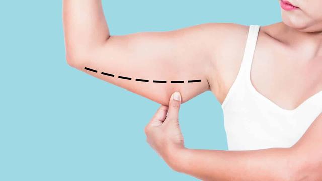 Winkearme reduzieren: Gezielte Übungen für straffe Oberarme Winkearme reduzieren: Gezielte Übungen für straffe Oberarme