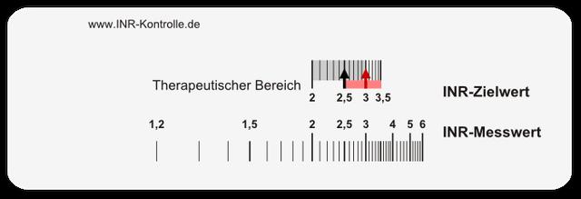 Marcumar und Reisen: Kontrolle des INR-Bereichs ohne Fingerstechen? Marcumar und Reisen: Kontrolle des INR-Bereichs ohne Fingerstechen?