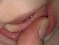 Wie sehen die ersten Zähne beim Durchbruch aus? Wie sehen die ersten Zähne beim Durchbruch aus?