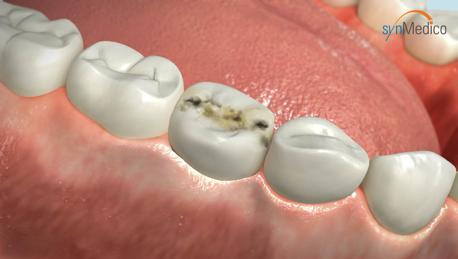 Selbstgemachte Zahnbehandlung: Erfahrungen und Empfehlungen Selbstgemachte Zahnbehandlung: Erfahrungen und Empfehlungen