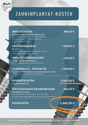 Was kostet ein Zahnimplantat in Deutschland? Alle wichtigen Informationen Was kostet ein Zahnimplantat in Deutschland? Alle wichtigen Informationen