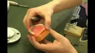 Vergleich der besten Zahnzusatzversicherungen für Prothesenunterfütterung Vergleich der besten Zahnzusatzversicherungen für Prothesenunterfütterung